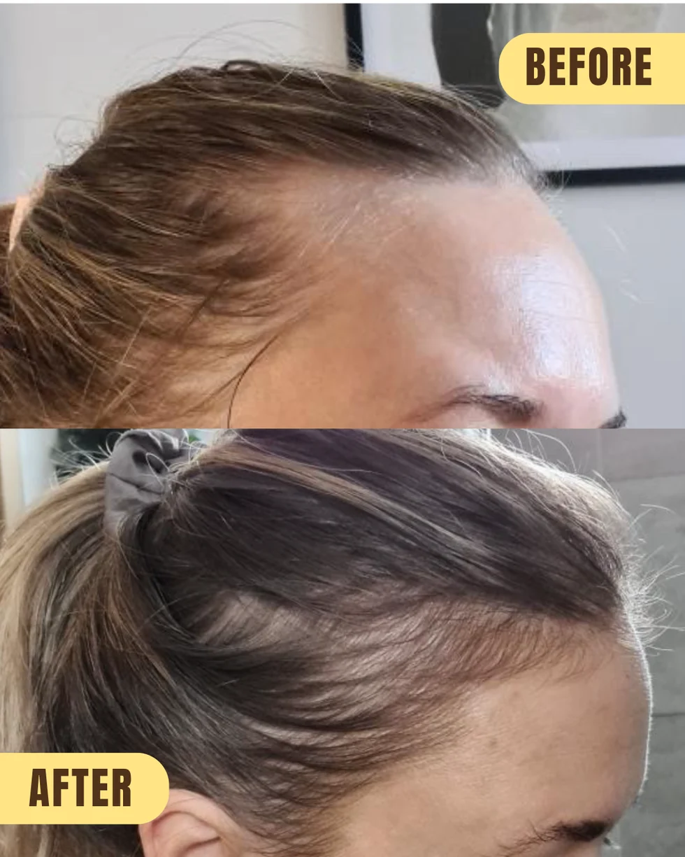 HAIR SYRUP Growsmary apjomu piešķiroša rozmarīna matu eļļa plāniem un retinātiem matiem, 100 ml - Image 3